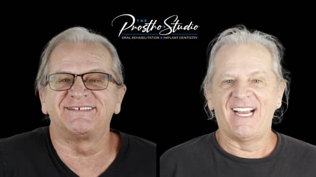 Slider image (3) The Prostho Studio